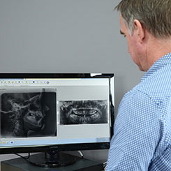 Orthodonticrecords Opt